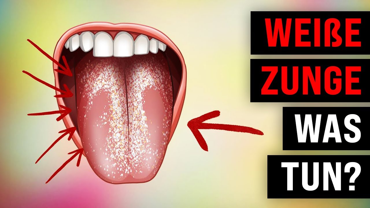 Elegantes Zunge Tut Weh Hinten Ebenbild