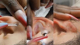 ASMR | Soft & Attentive Ear Cleaning 🧼 & Picking ~ dreamy whispers 💭 screenshot 1