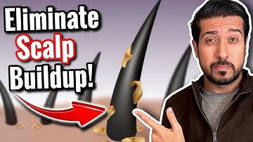 How to Eliminate Scalp Buildup in 5 Easy Steps
