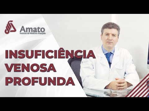 Vídeo: Qual é o termo médico para estase venosa?