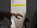 Cannula Insertion ✅#nurse #nursing #doctor #gnm #mbbs #neet #ytshorts #subscribe #youtubeshorts