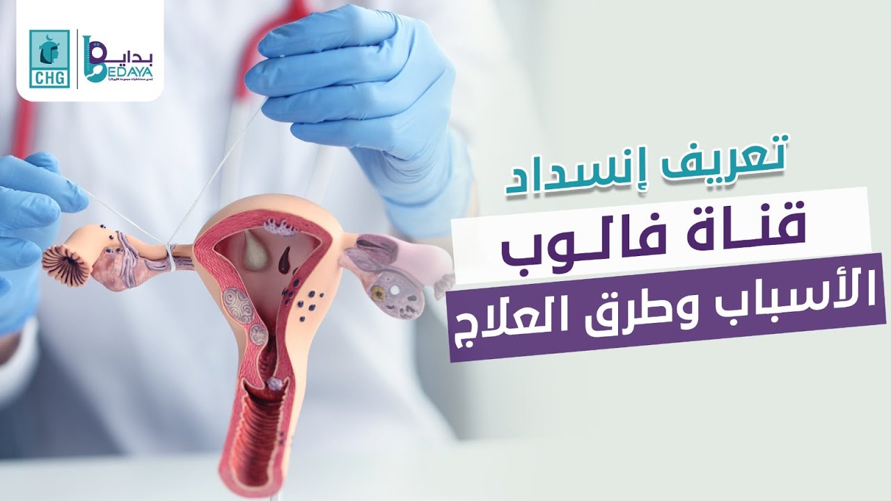 أسباب انسداد قناة فالوب وطرق العلاج