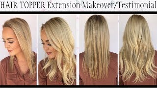 Remy Hair Topper Extension Makeover On Thinning Hair Testimonial
