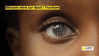 Blinzeln wird zur Qual I Trachom