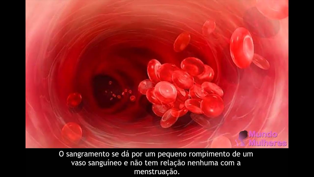 Menstruacao Dois Dias E Borra De Cafe