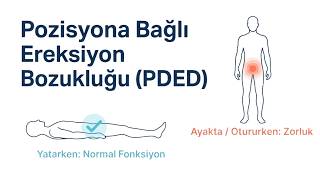 Pozisyona Bağlı Sertleşme Bozukluğu Pded