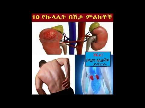 Ethiopia የኩላሊት በሽታ እንደያዘን የምናውቅበት 10 ምልክቶች