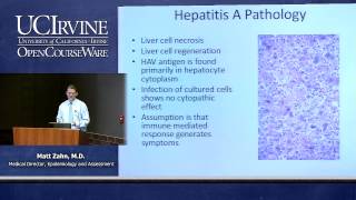 Hepatitis A: A National Outbreak in 2013