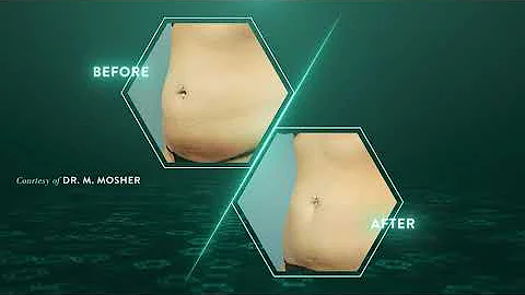 EVOLVE TITE - TONE - TRIM From Dr. Gregory Roche