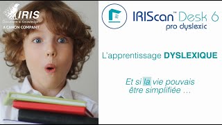 Tuto iScan Dys : Comment recalibrer votre scanner ? 