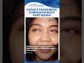 Bukti KDRT Mega Suryani Diabaikan Polisi hingga Dibunuh Suaminya: Aksi Kekerasan Disangkal Pelaku