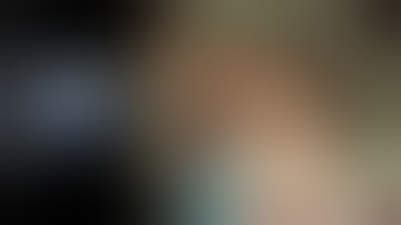 Case 22_STER for gastric SMT