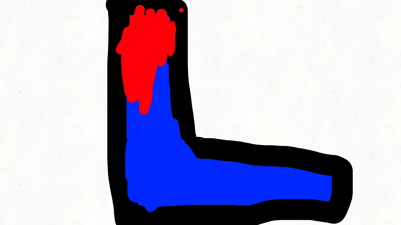 Loser island war map