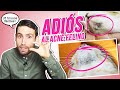 Cómo prevenir el ACNÉ FELINO en GATOS de forma muy sencilla 😾 | 5 trucos fáciles para mejorarlo 🖐️