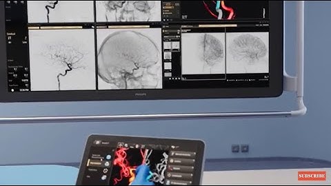 Get to know today’s Philips Azurion Image Guided Therapy