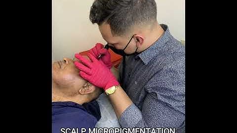 Scalp Micro pigmentation Reveal in Lafayette, LA.