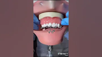 كيف طبيب الاسنان يبني افتح فمي 