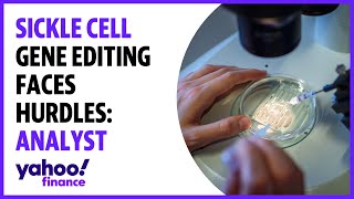 Sickle cell gene editing faces market hurdles: Analyst