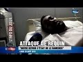 Attaque de requin  le mns raconte le sauvetage  29082016