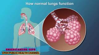Chronic Obstructive Pulmonary Disease (COPD) Awareness Day 2020