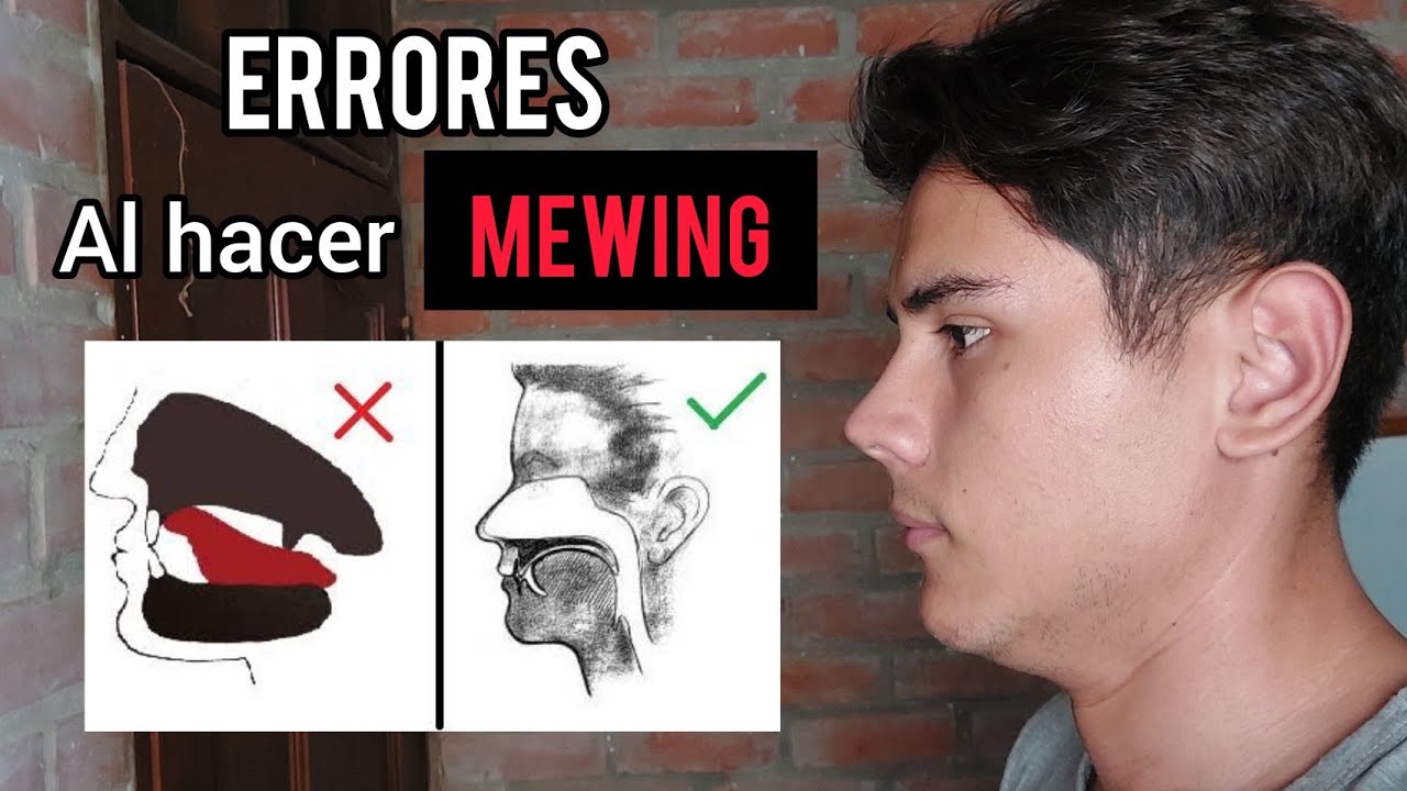 El MEWING: Como marcar la mandíbula