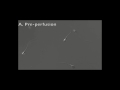 Human spermatozoa before & after entrapment by semen fibrils