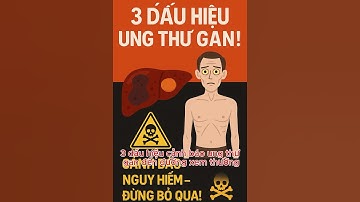 3 Dấu Hiệu Cảnh Báo Ung Thư Gan - Đừng Xem Thường