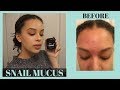 I Used Snail Cream on My Face for 2 Weeks | Mizon Black Snail Cream Review