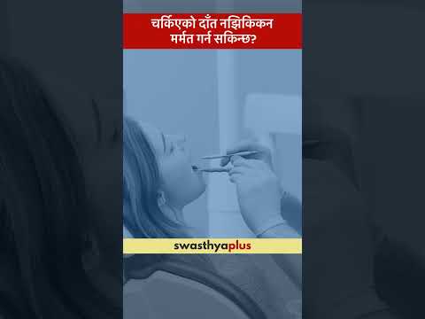 चर्किएको दाँत नझिकिकन मर्मत गर्न सकिन्छ? | Treatment of Cracked Teeth | Dr Gyanendra Sharma