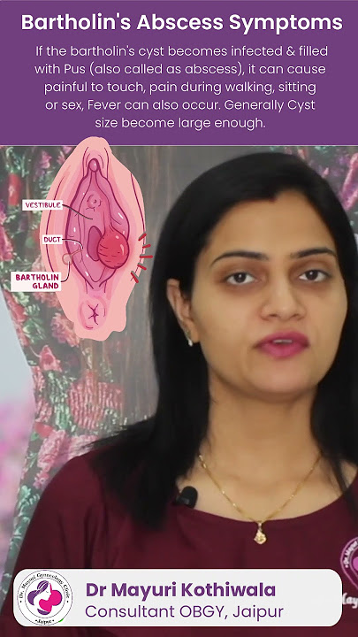 What are the symptoms of Bartholin Abscess? By Dr. Mayuri Kothiwala