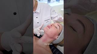 Птоз нижней трети лица: что делать #marutaka #красотаназдоровье #косметология#массаж #beauty #face