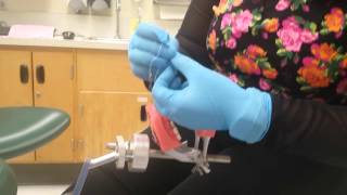Demonstrating Implant Crown Delivery