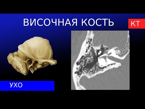 КТ-анатомия височной кости