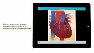 CardioVisual Free App screenshot 3