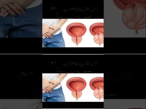 كيفية علاج تضخم البروستاتا وتقطيع التبول بالأعشاب وبدون أدوية