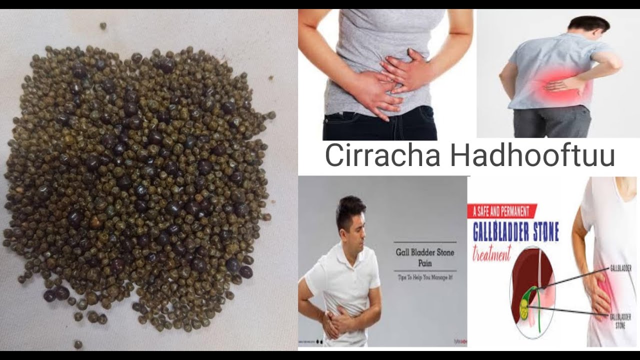 CIRRACHA HADHOOFTUU