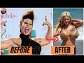 15 Celebrity Plastic Surgery Transformations That Surprised the World | Then and Now 2026