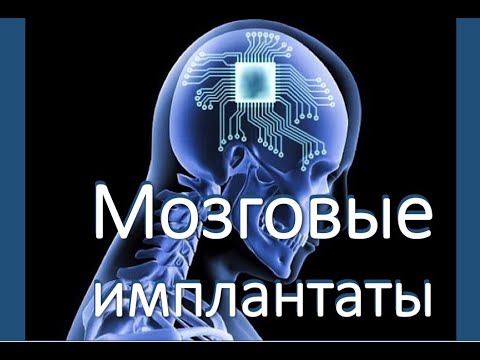 Мозговые имплантаты