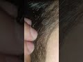 hair