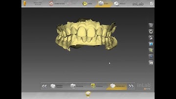 Jaw tracking device - SICAT Function with Inlab 16