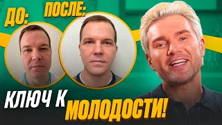 видео: Как стать моложе на 20 лет? Фейслифтинг. Смас-подтяжка. SMAS-лифтинг. Подтяжка лица. Омоложение лица картинка: Как стать моложе на 20 лет? Фейслифтинг. Смас-подтяжка. SMAS-лифтинг. Подтяжка лица. Омоложение лица
