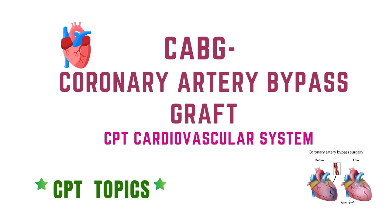 CABG/ CORONARY ARTERY BYPASS GRAFT| CPT TOPICS| MEDICAL CODING AND ...