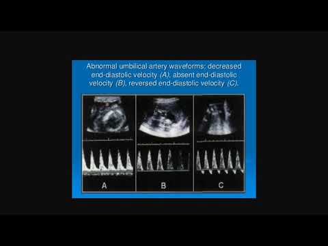 Recalls January 2021 MRCOG 1 ; session  3