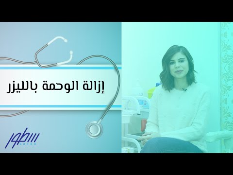 فيديو: هل يمكن إزالة الوحمات المصطبغة؟