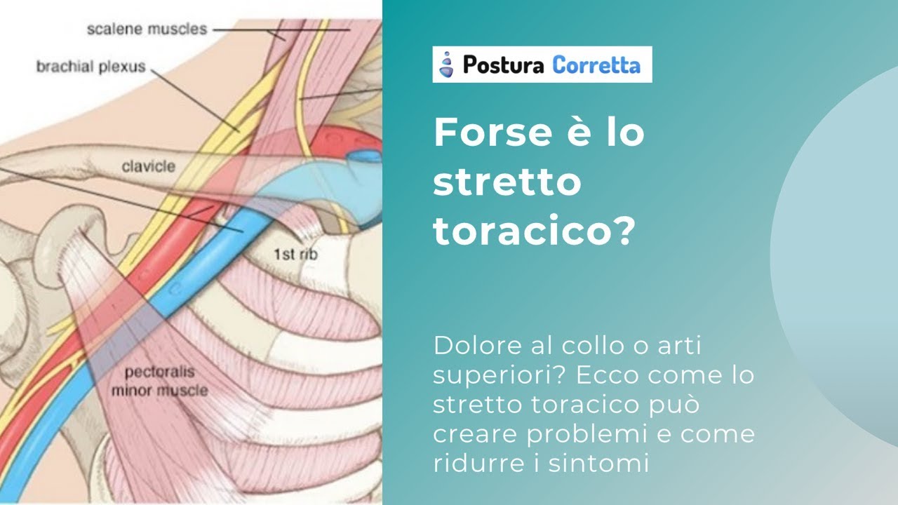 Dolore al collo o arti superiori?