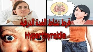 نتيجة تحليل TSH جد منخفضة, فرط نشاط الغدة الدرقية,فقدان الوزن بسرعة....Hyperthyroidie