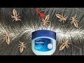 सर की जुएं और (lice) लिखें 1 बार मे खत्म हो जाएंगी / Lice removal at home