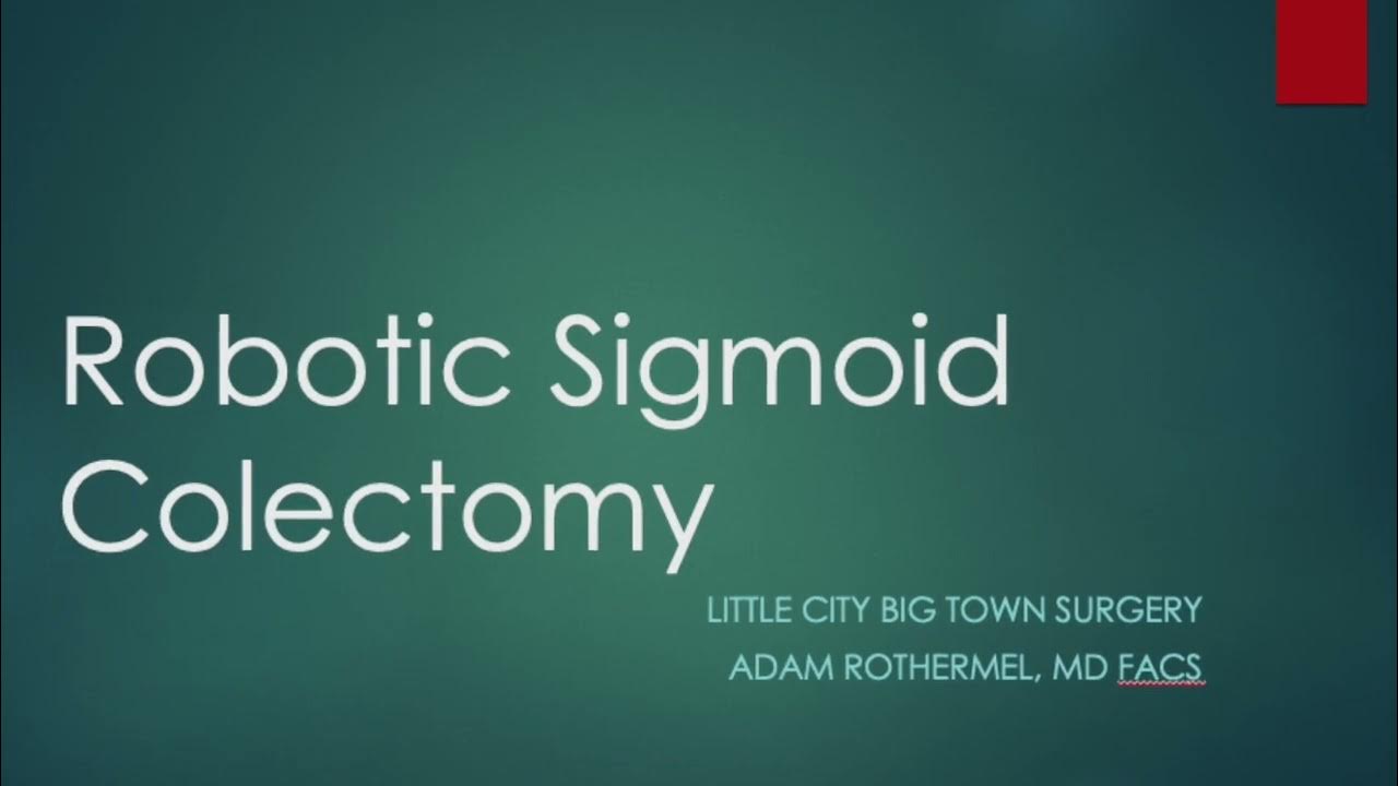 Robotic Sigmoid Colectomy, high BMI male YouTube