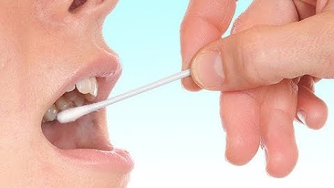 hướng dẫn tự thu mẫu niêm mạc miệng cho xét nghiệm ADN