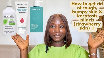 How to achieve a soft, smoother  skin texture| Get rid of rough, bumpy,ashy skin & keratosis pilaris